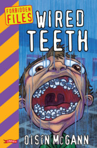 Cover of "Wired Teeth"